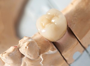 dental crown on a tooth model